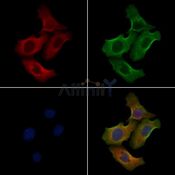 FST Antibody - DF4839 staining Hela cells by IF/ICC.