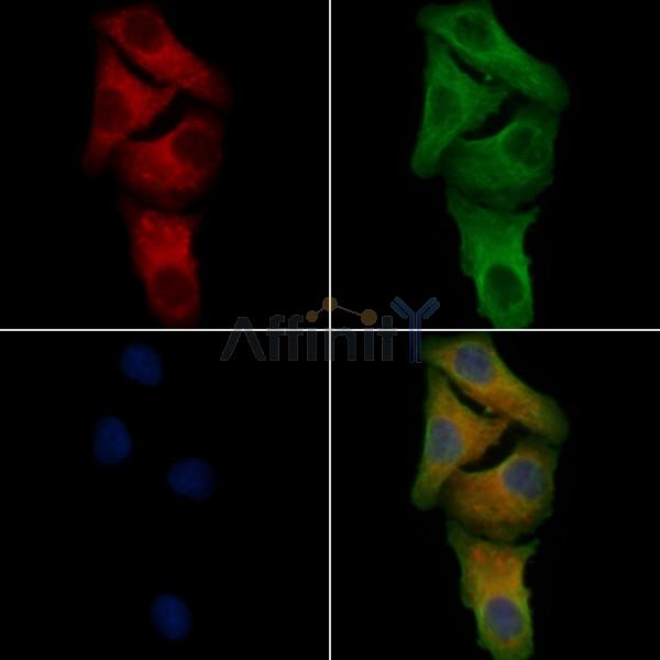 GPR174 Antibody - DF4902 staining Hela cells by IF/ICC.