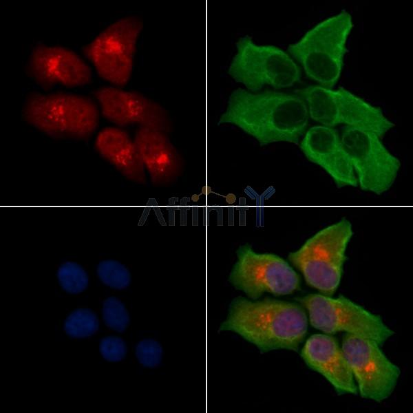 GPR107 Antibody - DF4939 staining Hela cells by IF/ICC.