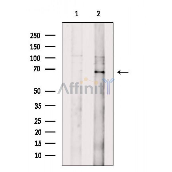 GPR107 Antibody - Western blot analysis of extracts from B16F10 cells, using GPR107 Antibody.
