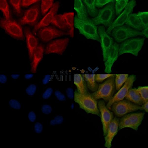 GPR142 Antibody - DF4949 staining Hela cells by IF/ICC.