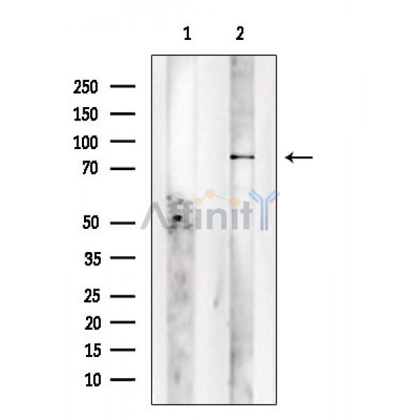 GPR149 Antibody - Western blot analysis of extracts from P19 cells, using GPR149 Antibody.