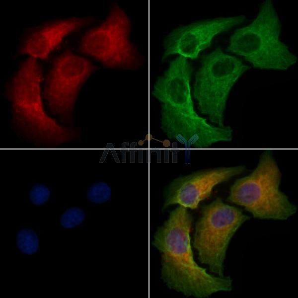 GPRC5B Antibody - DF4962 staining Hela cells by IF/ICC.