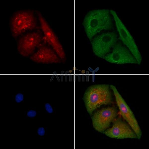 LGR6 Antibody - DF4983 staining A549 cells by IF/ICC.