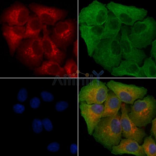 MCHR2 Antibody - DF4986 staining Hela cells by IF/ICC.