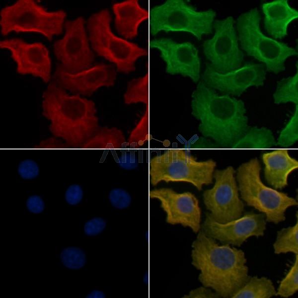 OR8G5 Antibody - DF5127 staining Hela cells by IF/ICC.