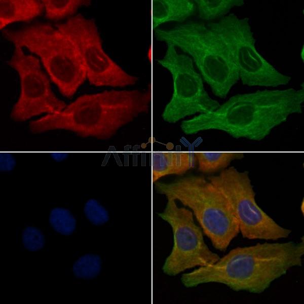 OR9Q2 Antibody - DF5135 staining Hela cells by IF/ICC.