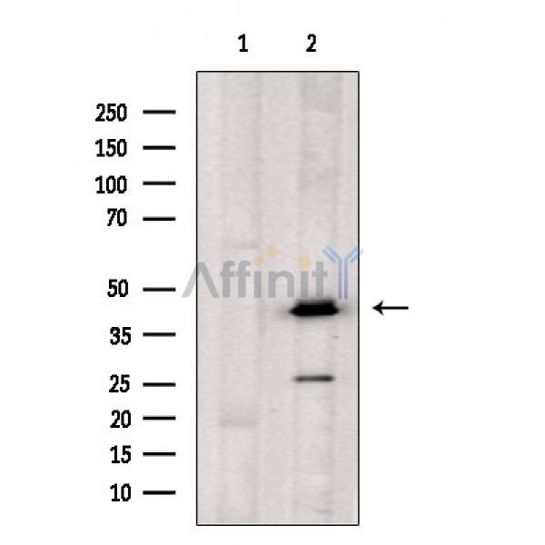 OXER1 Antibody - Western blot analysis of extracts from Mouse lung, using OXER1 Antibody.