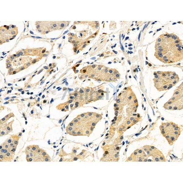 DDIT3/CHOP Antibody - DF6025 at 1/100 staining Human normal tissues adjacent to gastric cancer by IHC-P.