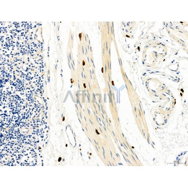 DDIT3/CHOP Antibody - DF6025 at 1/100 staining Human normal tissues adjacent to esophageal cancer by IHC-P.