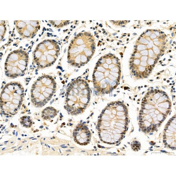 DDIT3/CHOP Antibody - DF6025 at 1/100 staining Human normal tissues adjacent to colorectal cancer by IHC-P.