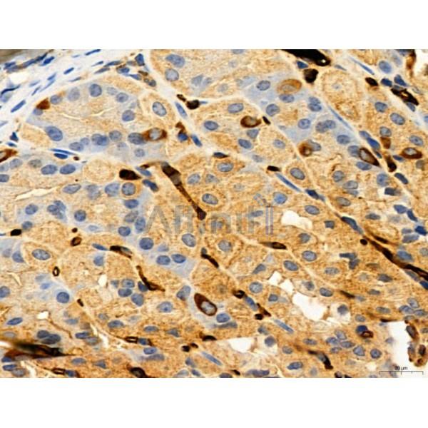 DDIT3/CHOP Antibody - DF6025 at 1/100 staining Mouse stomach tissue by IHC-P.