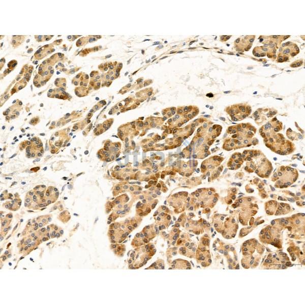 DDIT3/CHOP Antibody - DF6025 at 1/100 staining Human normal tissues adjacent to pancreatic cancer by IHC-P.
