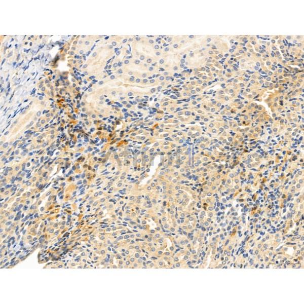 DDIT3/CHOP Antibody - DF6025 at 1/100 staining Rat kidney tissue by IHC-P.