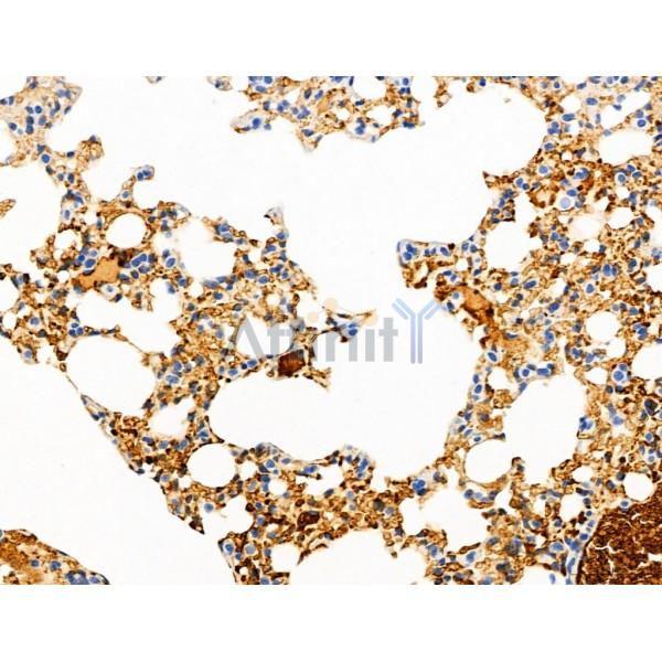 DDIT3/CHOP Antibody - DF6025 at 1/100 staining Mouse lung tissue by IHC-P.