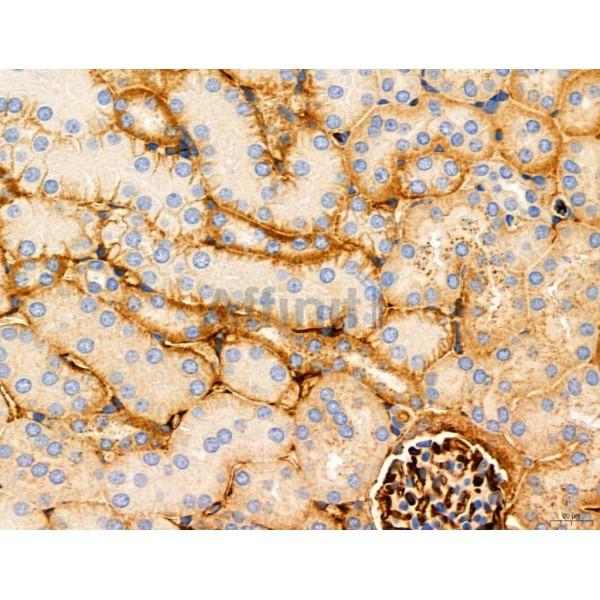 DDIT3/CHOP Antibody - DF6025 at 1/100 staining Mouse kidney tissue by IHC-P.