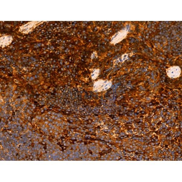 DDIT3/CHOP Antibody - DF6025 at 1/100 staining Mouse spleen tissue by IHC-P.