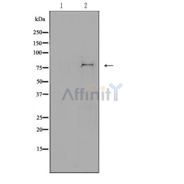CDH13 Antibody - Western blot analysis of extracts from mouse heart, using CDH13 antibody.