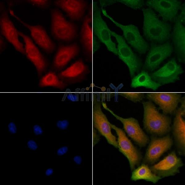 REG3G Antibody - DF6869 staining A549 cells by IF/ICC.
