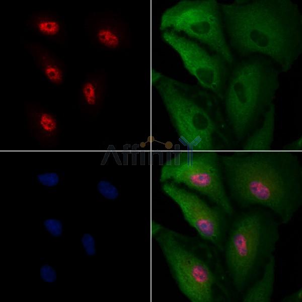 SPDYA Antibody - DF6876 staining A549 cells by IF/ICC.