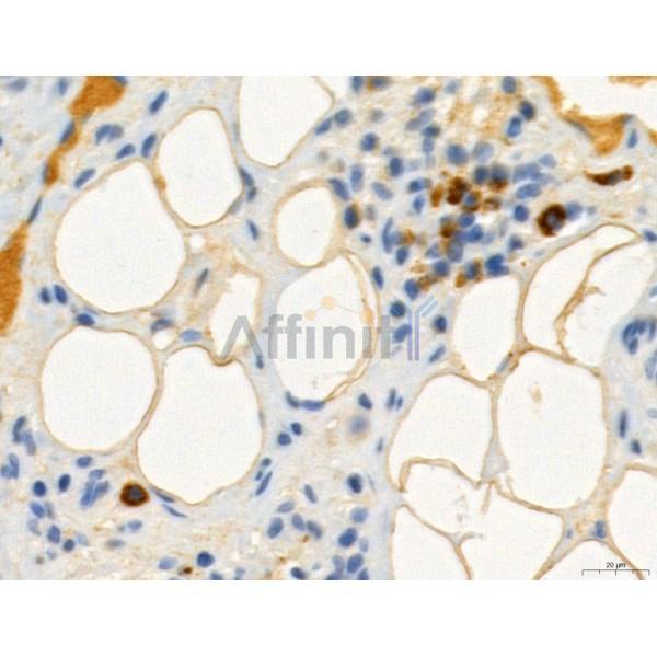 RANKL Antibody - DF7006 at 1/100 staining Rat lung tissue by IHC-P.