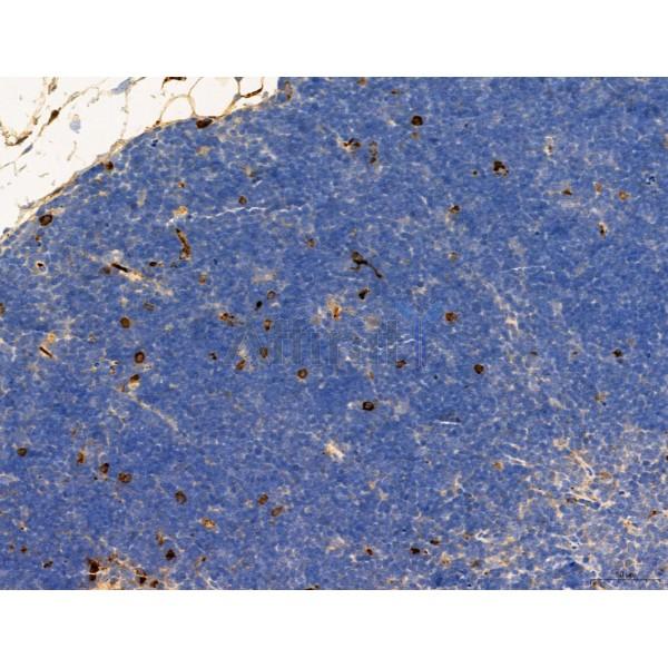 RANKL Antibody - DF7006 at 1/100 staining Mouse thymus tissue by IHC-P.
