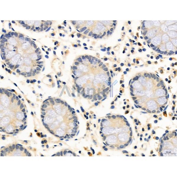 RANKL Antibody - DF7006 at 1/100 staining Human normal tissues adjacent to colorectal cancer by IHC-P.