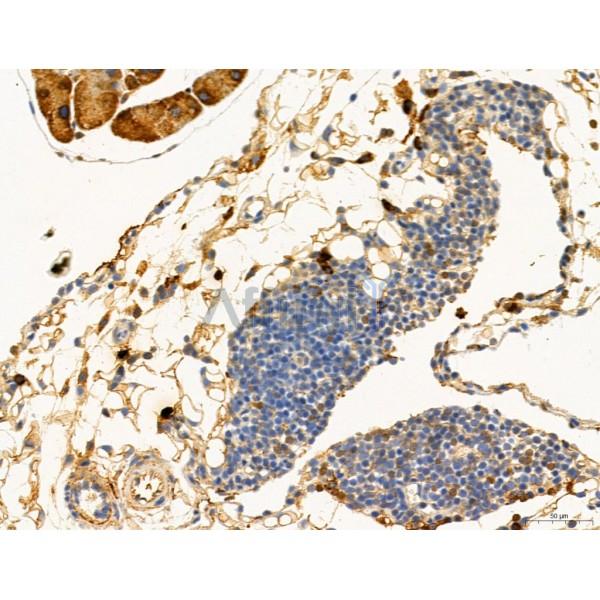RANKL Antibody - DF7006 at 1/100 staining Mouse stomach tissue by IHC-P.