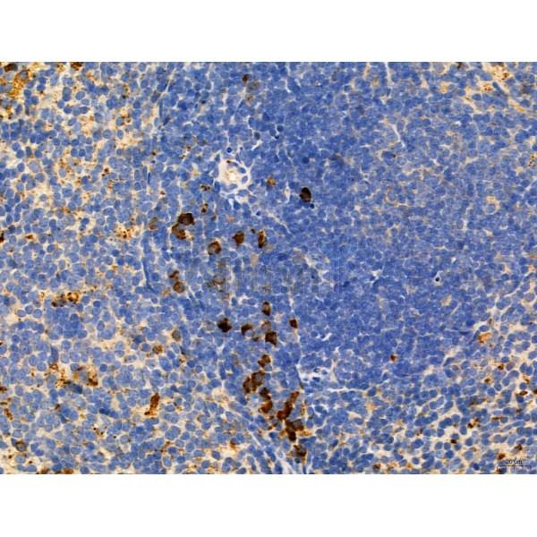 RANKL Antibody - DF7006 at 1/100 staining Mouse spleen tissue by IHC-P.