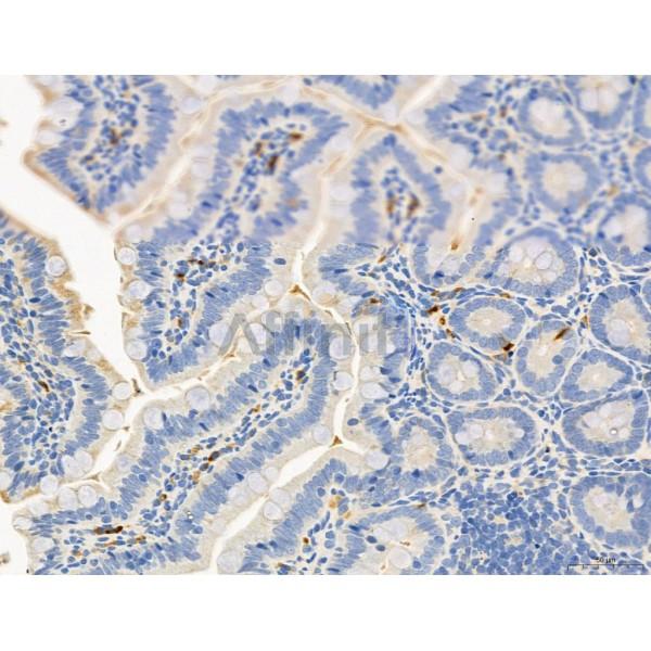 RANKL Antibody - DF7006 at 1/100 staining Rat colon tissue by IHC-P.