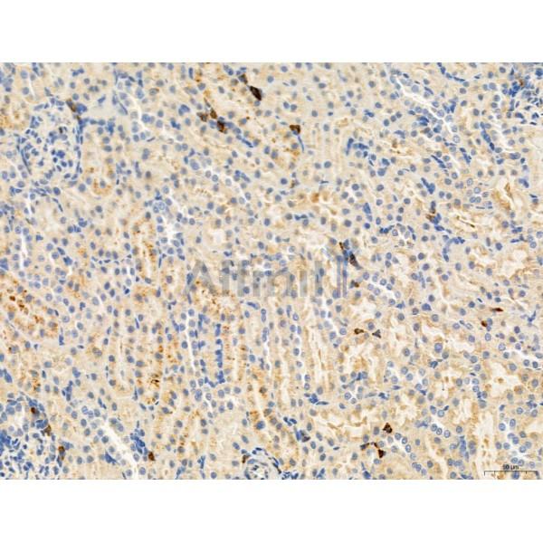RANKL Antibody - DF7006 at 1/100 staining Rat kidney tissue by IHC-P.