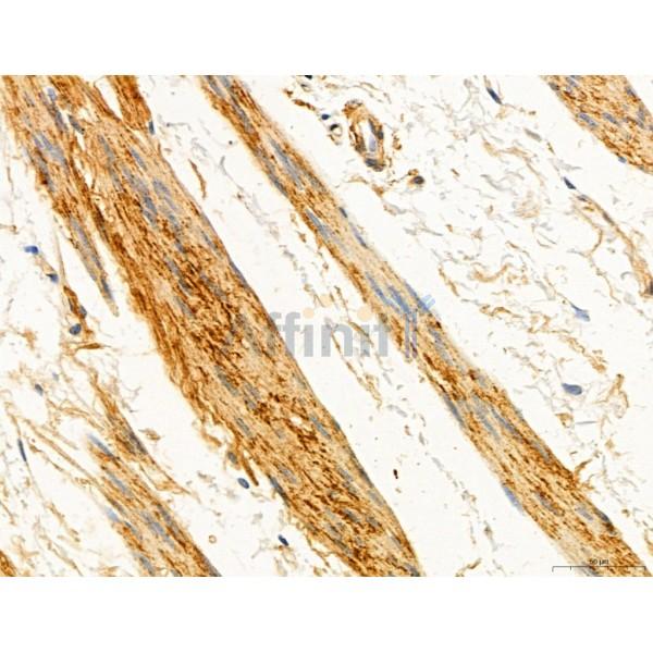 KISS1R Antibody - DF7123 at 1/100 staining Human normal tissues adjacent to esophageal cancer by IHC-P.