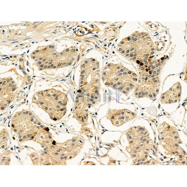 KISS1R Antibody - DF7123 at 1/100 staining Human normal tissues adjacent to gastric cancer by IHC-P.