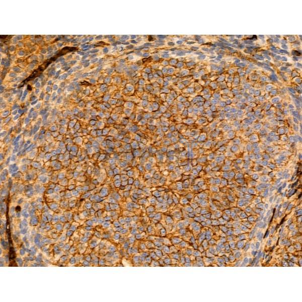 KISS1R Antibody - DF7123 at 1/100 staining Mouse ovary tissue by IHC-P.