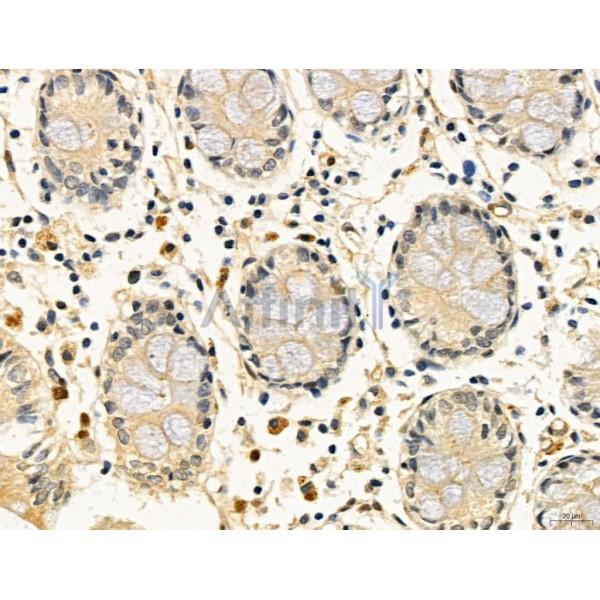 KISS1R Antibody - DF7123 at 1/100 staining Human normal tissues adjacent to colorectal cancer by IHC-P.