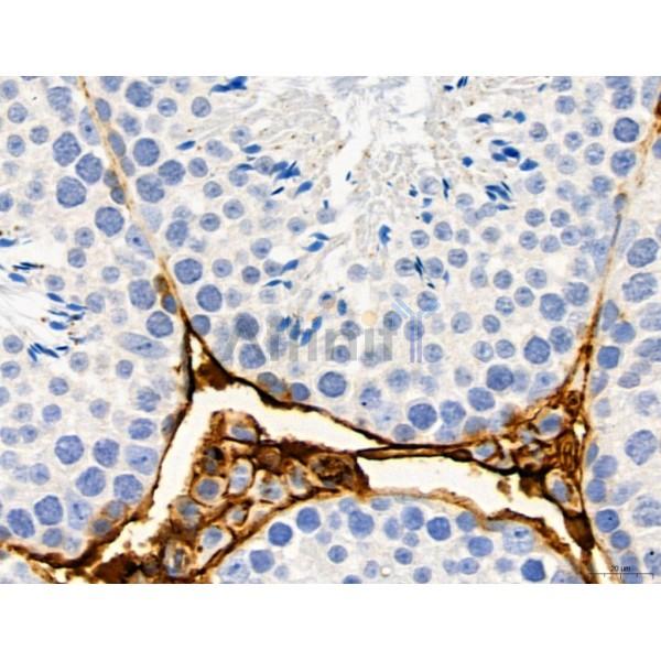 KISS1R Antibody - DF7123 at 1/100 staining Mouse testis tissue by IHC-P.
