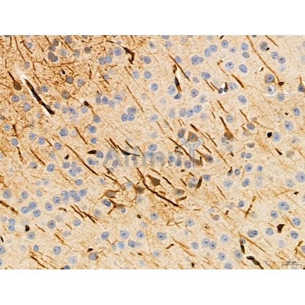 KISS1R Antibody - DF7123 at 1/100 staining Mouse brain tissue by IHC-P.