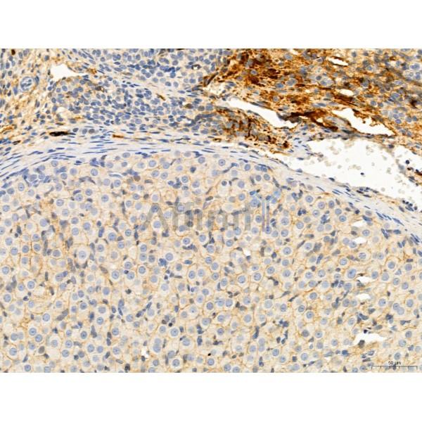 KISS1R Antibody - DF7123 at 1/100 staining Rat ovary tissue by IHC-P.