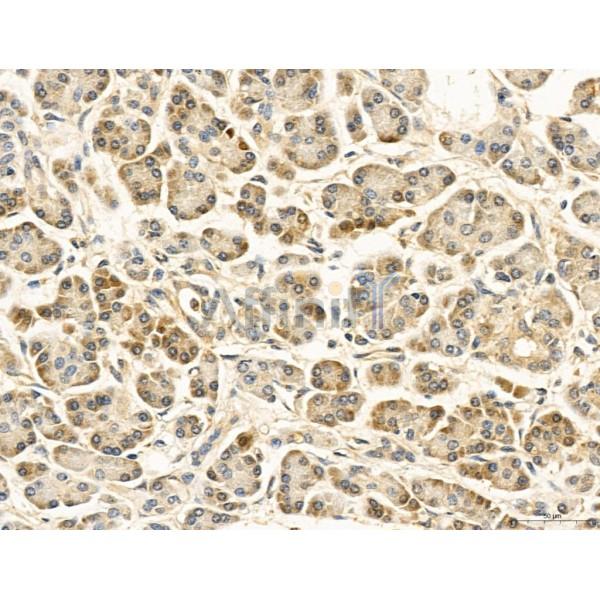 KISS1R Antibody - DF7123 at 1/100 staining Human normal tissues adjacent to pancreatic cancer by IHC-P.