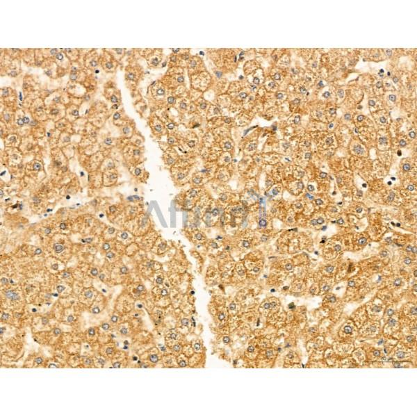KISS1R Antibody - DF7123 at 1/100 staining Human normal tissues adjacent to liver cancer by IHC-P.