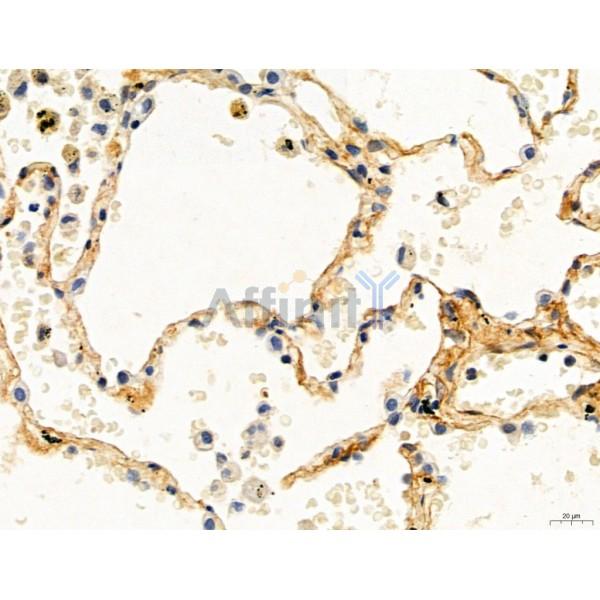 KISS1R Antibody - DF7123 at 1/100 staining Human normal tissues adjacent to lung cancer by IHC-P.