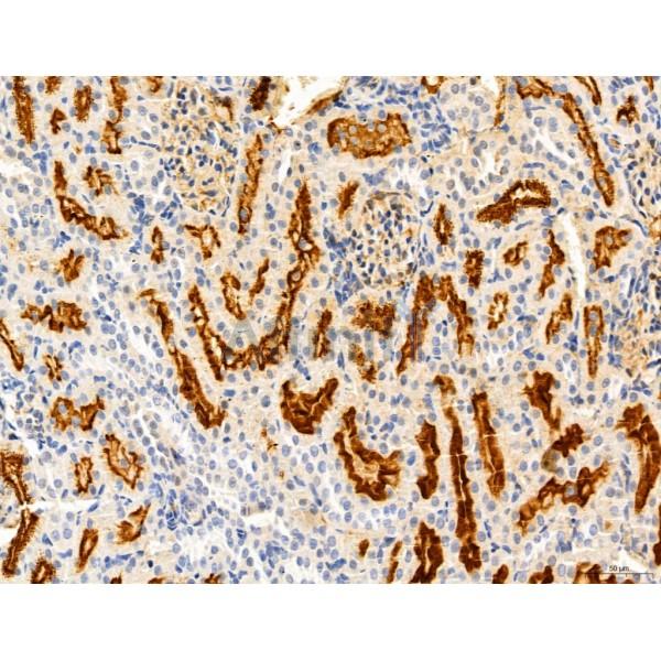 KISS1R Antibody - DF7123 at 1/100 staining Rat kidney tissue by IHC-P.