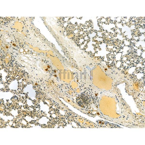 MUC16 Antibody - DF7989 at 1/100 staining Rat lung tissue by IHC-P.