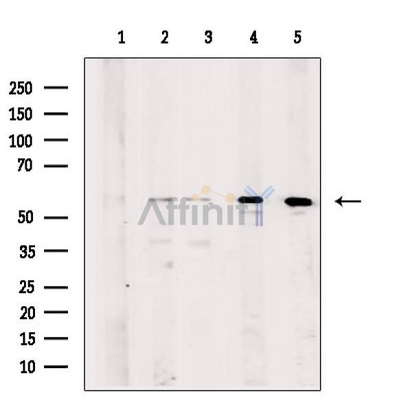 KATNA1 Antibody - Western blot analysis of extracts from various samples, using KATNA1 Antibody.