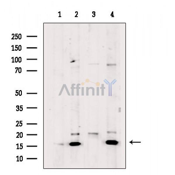 UBE2L3 Antibody - Western blot analysis of extracts from various samples, using UBE2L3 Antibody.