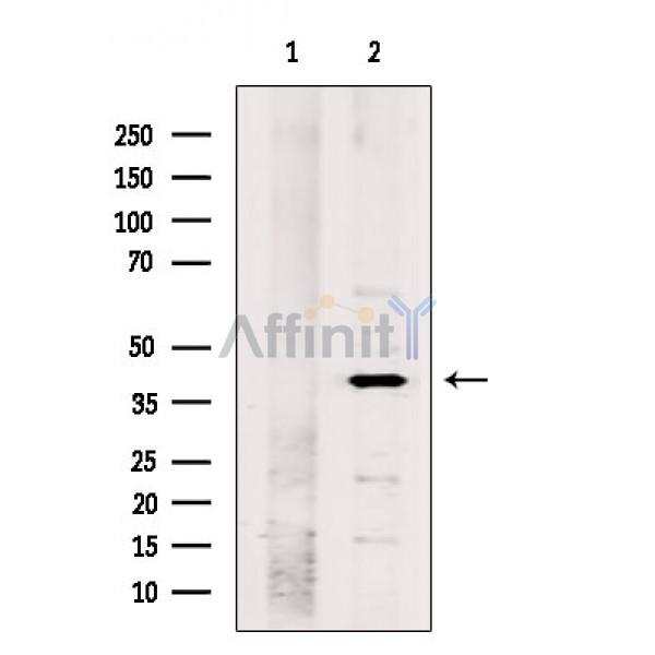 MBD2 Antibody - Western blot analysis of extracts from B16F10 cells, using MBD2 Antibody.