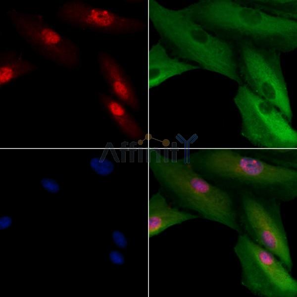 CENPH Antibody - DF9058 staining A549 cells by IF/ICC.