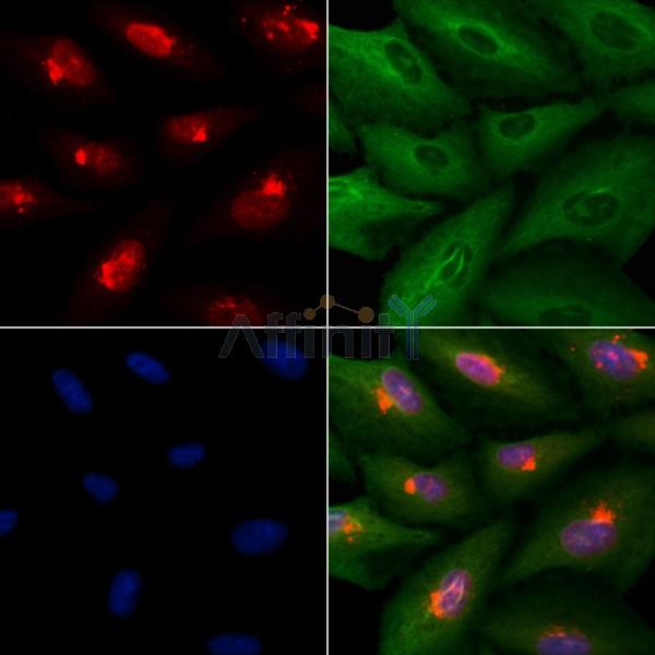 ACTL6B Antibody - DF9072 staining A549 cells by IF/ICC.
