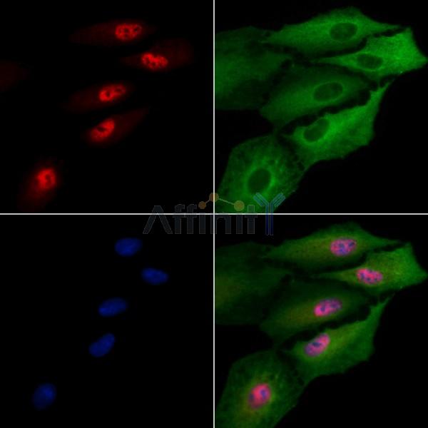 SP5 Antibody - DF9081 staining A549 cells by IF/ICC.