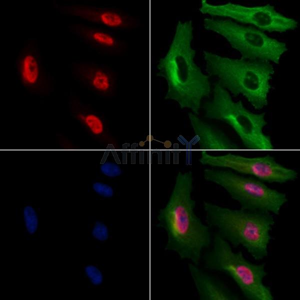 NIP7 Antibody - DF9138 staining A549 cells by IF/ICC.